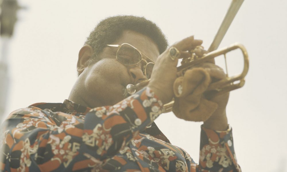 Never miss a beat: trumpet player who lost everything inspires through  music